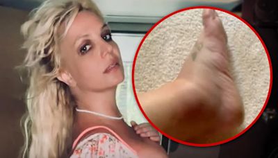 Britney Spears Shows Off Swollen Ankle After Hotel Incident