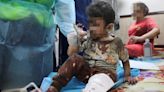 以巴衝突／近40萬人受困加薩城內 民眾失孩子悲喊：讓我死