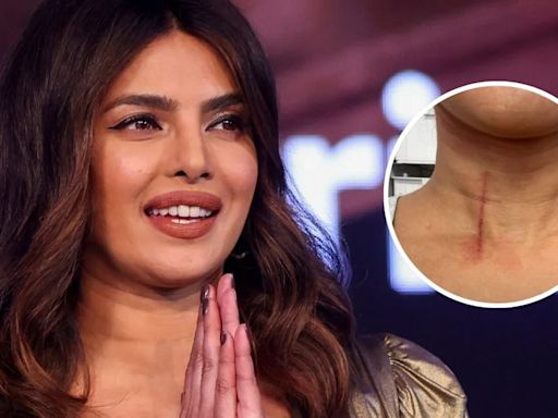 Priyanka Chopra se hirió la garganta mientras grababa una película: “Son los riesgos del trabajo”