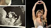 Pregnant Swiftie Spots Her Baby Making Taylor Swift's Signature 'Heart Hands' in Sonogram (Exclusive)