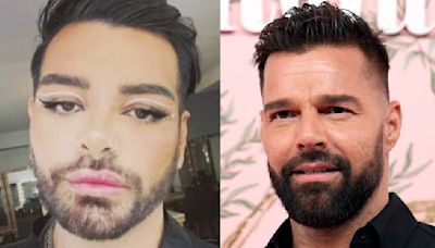 Hombre se somete a más de 30 cirugías para parecerse a Ricky Martin: por poco encuentra la muerte