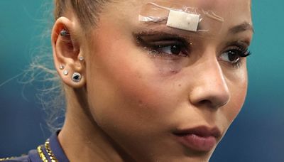 What happened to Flavia Saraiva? Brazilian gymnast has bandage over eyebrow