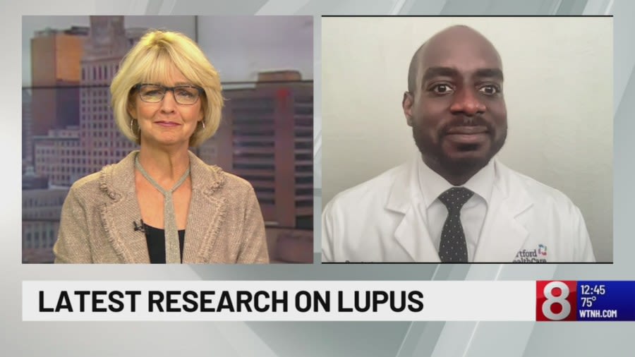 Latest research on lupus