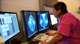 Es gibt kein Mammographie-Verbot in der Schweiz