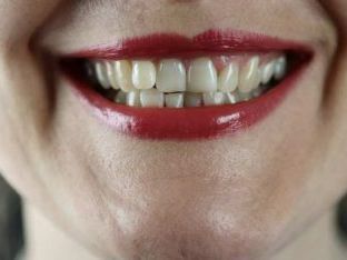 好想擺脫黃牙！6大牙齒美白方式找回自信笑容