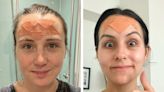 We tried face taping, a Botox alternative, to smooth wrinkles. It worked like magic — for a few hours.