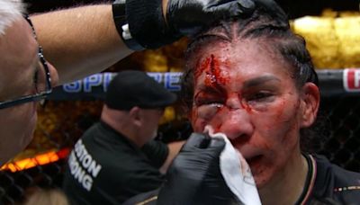 ¡Para ver y no creer! El espeluznante corte de Irene Aldana que cierra los preliminares en UFC 306