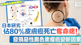 黑色素瘤丨日本研究：佔80%皮膚癌死亡的「奪命痣」！發現惡性黑色素瘤癌變新因素。