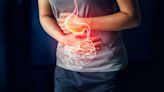 Bloating in IBS-C: Can Plecanatide Help Patients?