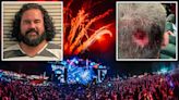 Drugged-out Florida man arrested after biting off piece of cop’s head at music festival