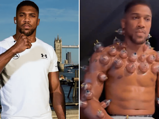 Anthony Joshua explains viral cupping therapy video that left fans baffled