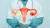 One In 10 Women In The UK At Increased Risk’ Of Ovarian Cancer; Know Why