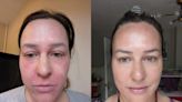 Mother whose eczema made it feel like her ‘skin cried’ reveals how she transformed her complexion