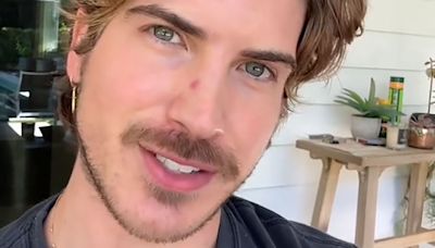 YouTuber Joey Graceffa Shares Skin Cancer Diagnosis - E! Online