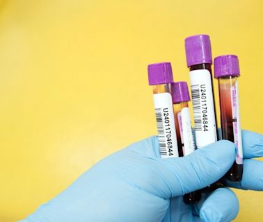 Panel recommends blood test to detect colon cancer for FDA approval