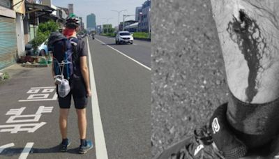 等公車「站牌前挨撞」小腿爆血 洋男行程被迫喊卡：台南是行人地獄首都