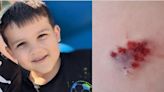 Boy, 5, attacked by two dogs while walking down street with aunt