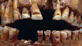 Viking teeth show signs of 'initiation ritual' that acted as a form of ID