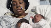 Doctors had to hack off my legs, hands and fingers days after I gave birth