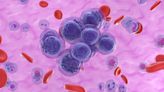 Venetoclax Combo Safe, Effective in AML Patients Age 80 and Up, Real-World Data Show