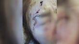 'She's in a lot of pain': Grandma suffers broken bones from an attack outside south Phoenix grocery store
