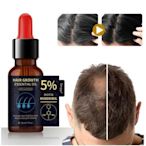 康康樂 買2送1 生薑王頭髮營養液養育頭髮根防止脫落控油5%Minoxidil精華液