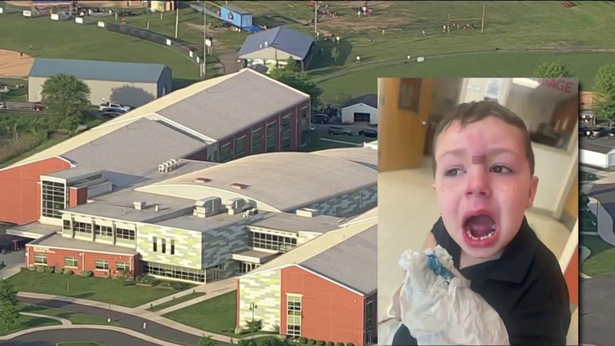 Bucks County father seeks answers after 5-year-old son attacked at school and hospitalized