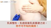 乳房整形、乳房術後乳房重建之前，妳不可不知的風險！ | 蕃新聞