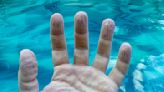 Why do fingers get wrinkly after a long bath or swim? A biomedical engineer explains