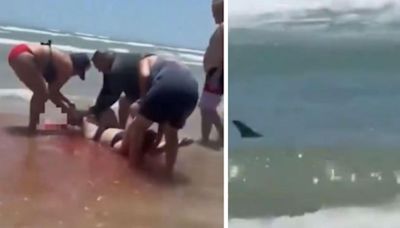 Imágenes sensibles: un tiburón arranca de cuajo la pierna a una bañista en Texas