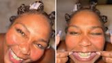 Lizzo Shows Off Freckles — and Dazzling Diamond Grills — in Series of Makeup-Free Selfies