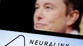 Neuralink: reportan las primeras fallas del chip implantado a un cerebro humano