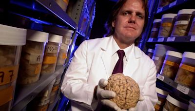 Los secretos sobre nuestro cerebro que reveló uno de los más singulares y ambiciosos estudios jamás realizado