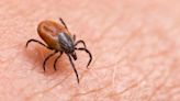 Bitten by a tick? Here's the trick to handling it in a safe manner