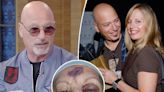 Howie Mandel found wife in pool of blood with skull exposed after ‘tipsy’ fall in Las Vegas hotel