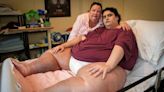 重達317kg！全英國「最肥胖男人」器官衰竭過世 享年33歲