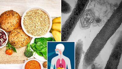 Colorectal cancer is rising among young adults — could this diet be to blame?