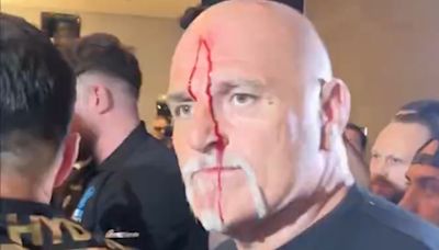 Pai de Tyson Fury fica coberto de sangue após confusão com equipe de Usyk; veja vídeo