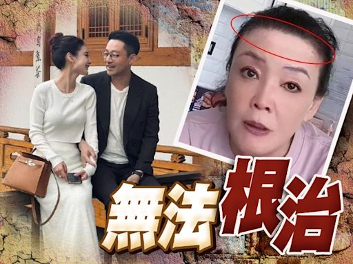 汪小菲新老婆過門僅一周 張蘭忽然驚爆患不治之症