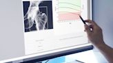 Is Osteoporosis Genetic?