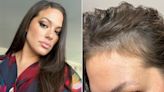 Ashley Graham Reveals Her Hairline Is Growing Back in After It Fell Out Following Her Pregnancy