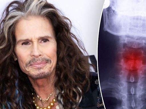 Steven Tyler’s career-ending throat injury: How dangerous is a fractured larynx?