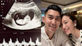 2年前女兒出生僅4天夭折！毛加恩老婆宣布懷孕 爆「出血停工安胎」