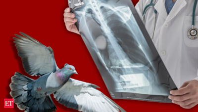 How pigeon exposure can cause irreparable disease. Here’s what you must know - The Economic Times