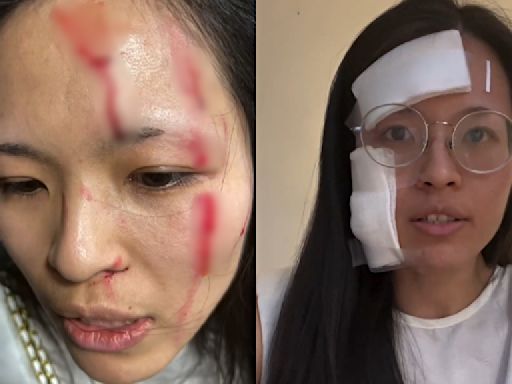 Asian woman 'needs her city back' after violent attack in NYC