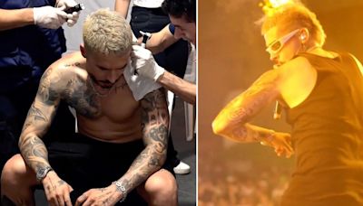 Terrifying moment singer's hair goes up in flames while on stage