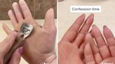 A TikToker named 'Parmesan Palms' has captivated millions by shaving callouses off her hands and feet due to a rare skin condition