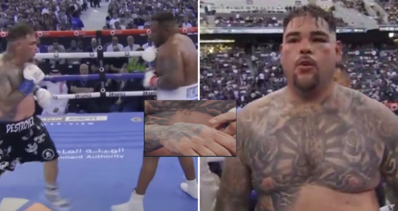Backstage footage shows the gruesome hand injury Andy Ruiz suffered vs Jarrell Miller