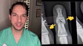 Surgeon reveals bizzare things he’s removed from people’s hands