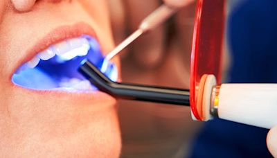 Teeth Whitening Buffalo Unveils Innovative “Smile Transformation Program” to Elevate Dental Health and Confidence